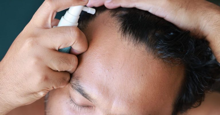 FDA Issues Warning on Hair-Loss Product Finasteride, Citing Side Effects